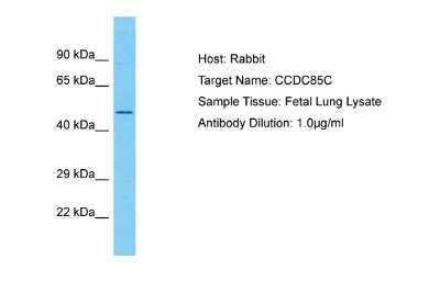 Western Blot: CCDC85C Antibody [NBP2-82621]