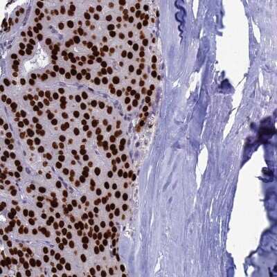 Immunohistochemistry-Paraffin: CCDC86 Antibody [NBP1-93500]