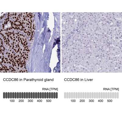 Immunohistochemistry-Paraffin: CCDC86 Antibody [NBP1-93500]