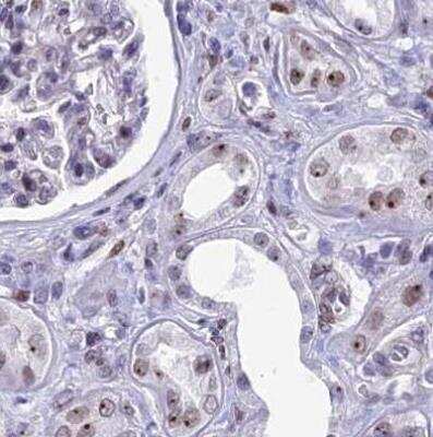Immunohistochemistry-Paraffin: CCDC86 Antibody [NBP1-93500]