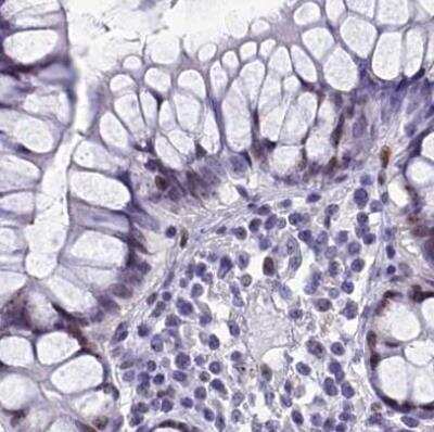 Immunohistochemistry-Paraffin: CCDC86 Antibody [NBP1-93500]
