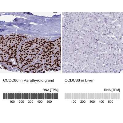 Immunohistochemistry-Paraffin: CCDC86 Antibody [NBP1-93500]