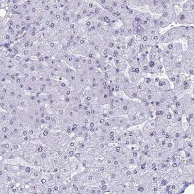 Immunohistochemistry-Paraffin: CCDC86 Antibody [NBP1-93500]