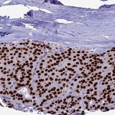 Immunohistochemistry-Paraffin: CCDC86 Antibody [NBP1-93500]