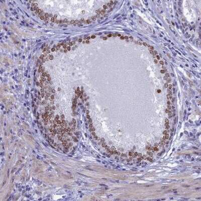 Immunohistochemistry-Paraffin: CCDC86 Antibody [NBP1-93500]