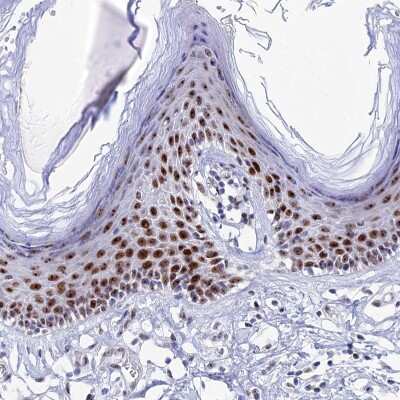 Immunohistochemistry-Paraffin: CCDC86 Antibody [NBP1-93500]