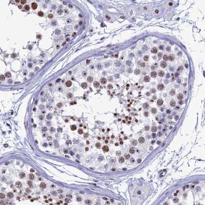 Immunohistochemistry-Paraffin: CCDC86 Antibody [NBP1-93500]