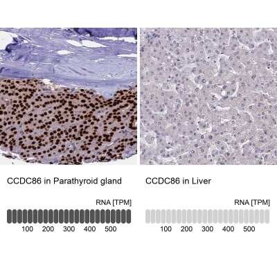 Immunohistochemistry-Paraffin: CCDC86 Antibody [NBP1-93501]