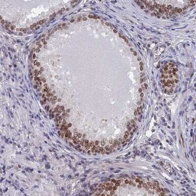Immunohistochemistry-Paraffin: CCDC86 Antibody [NBP1-93501]
