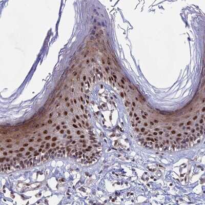 Immunohistochemistry-Paraffin: CCDC86 Antibody [NBP1-93501]