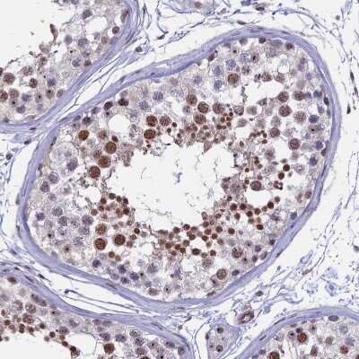 Immunohistochemistry-Paraffin: CCDC86 Antibody [NBP1-93501]