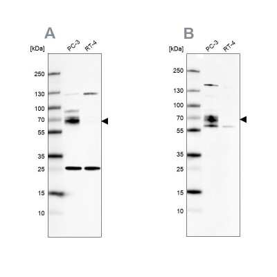 Western Blot: CCDC86 Antibody [NBP1-93500]