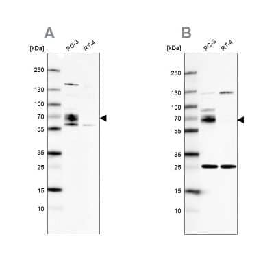 Western Blot: CCDC86 Antibody [NBP1-93501]