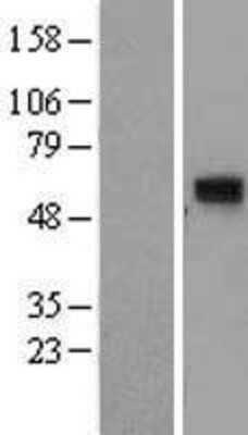 Western Blot: CCDC86 Overexpression Lysate [NBP2-06356]