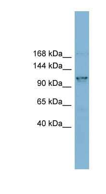 Western Blot: CCDC87 Antibody [NBP1-56880]