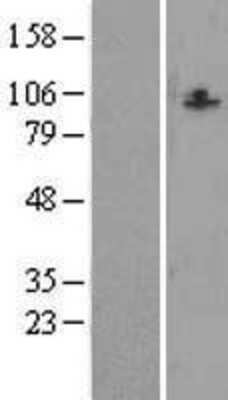 Western Blot: CCDC87 Overexpression Lysate [NBL1-08827]