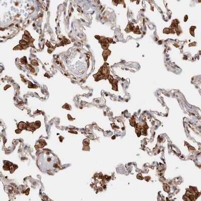 Immunohistochemistry-Paraffin: CCDC88B Antibody [NBP1-88350]