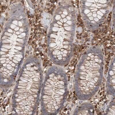 Immunohistochemistry-Paraffin: CCDC88B Antibody [NBP1-88350]