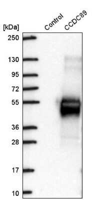 Western Blot: CCDC89 Antibody [NBP2-57795]