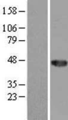 Western Blot: CCDC89 Overexpression Lysate [NBL1-08828]