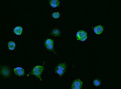 Immunocytochemistry/ Immunofluorescence: CCDC9 Antibody [NBP3-05897]