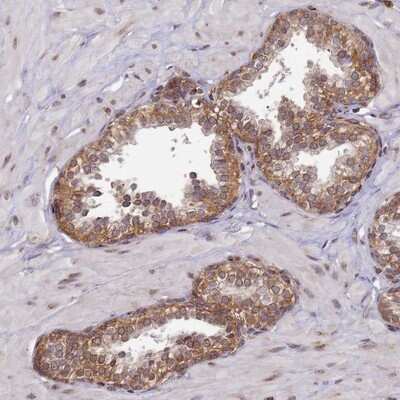 Immunohistochemistry-Paraffin: CCDC9 Antibody [NBP1-91765]
