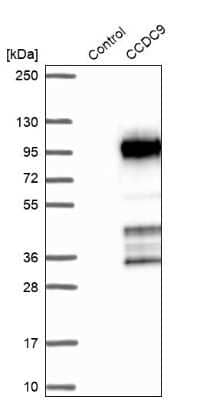 Western Blot: CCDC9 Antibody [NBP1-91765]