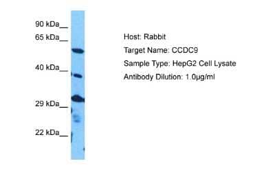 Western Blot: CCDC9 Antibody [NBP2-84629]