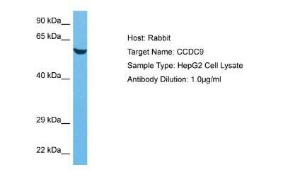 Western Blot: CCDC9 Antibody [NBP2-84630]