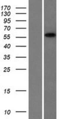 Western Blot: CCDC9 Overexpression Lysate [NBL1-08829]