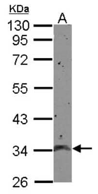 Western Blot: CCDC90A Antibody [NBP2-15755]