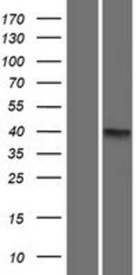 Western Blot: CCDC90A Overexpression Lysate [NBP2-08590]