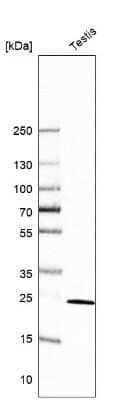 Western Blot: CCDC90B Antibody [NBP1-93528]