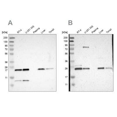 Western Blot: CCDC90B Antibody [NBP1-93529]