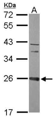 Western Blot: CCDC90B Antibody [NBP2-15756]