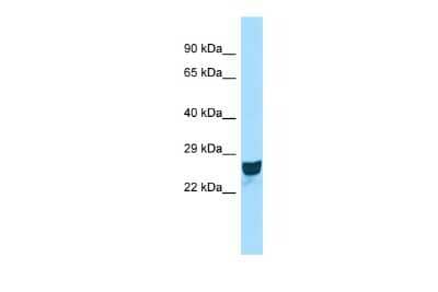 Western Blot: CCDC90B Antibody [NBP2-87154]