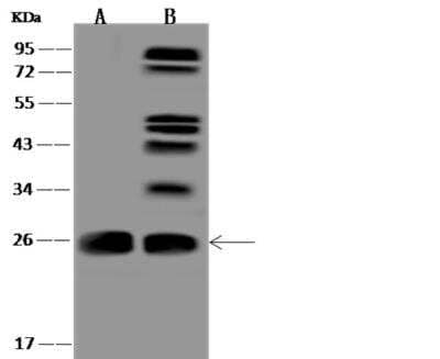 Western Blot: CCDC90B Antibody [NBP3-05879]