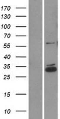 Western Blot: CCDC90B Overexpression Lysate [NBP2-06515]