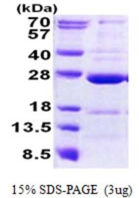 SDS-PAGE: Recombinant Human CCDC90B His Protein [NBP2-22790]