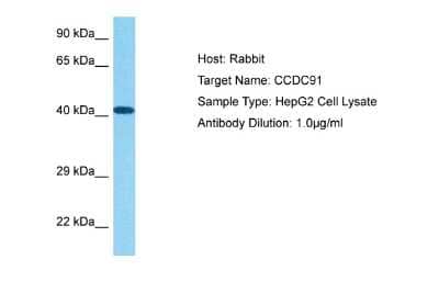 Western Blot: CCDC91 Antibody [NBP2-84632]