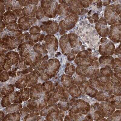 Immunohistochemistry-Paraffin: CCDC92 Antibody [NBP1-82119]