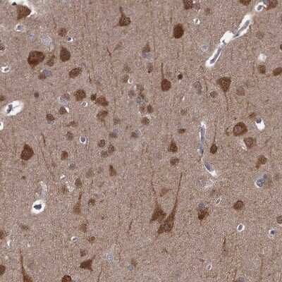 Immunohistochemistry-Paraffin: CCDC92 Antibody [NBP1-82119]