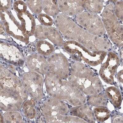 Immunohistochemistry-Paraffin: CCDC92 Antibody [NBP1-82119]