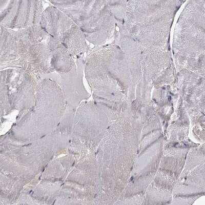 Immunohistochemistry-Paraffin: CCDC92 Antibody [NBP1-82119]