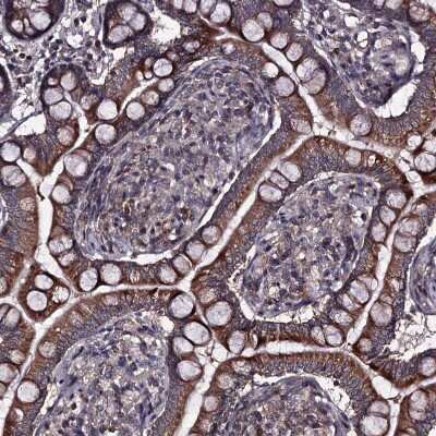 Immunohistochemistry-Paraffin: CCDC92 Antibody [NBP1-82119]