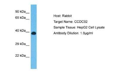 Western Blot: CCDC92 Antibody [NBP2-84634]