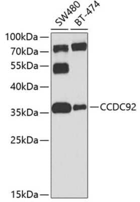 Western Blot: CCDC92 AntibodyBSA Free [NBP2-92829]