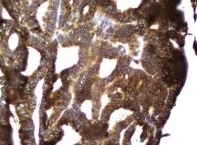 Immunohistochemistry: CCDC93 Antibody (OTI6E11) [NBP2-45588]