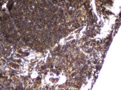 Immunohistochemistry: CCDC93 Antibody (OTI6E11) [NBP2-45588]