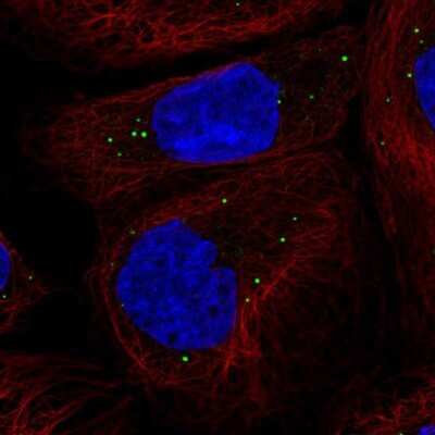 Immunocytochemistry/ Immunofluorescence: CCDC93 Antibody [NBP2-30369]